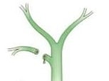 Bile Duct Injuries